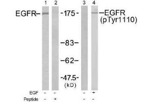 Image no. 1 for anti-Epidermal Growth Factor Receptor (EGFR) (pTyr1110) antibody (ABIN197027) (EGFR 抗体  (pTyr1110))