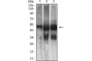 Western blot analysis using TUBB3 mouse mAb against NIH/3T3 (1), Hela (2), and A549 (3) cell lysate. (TUBB3 抗体)