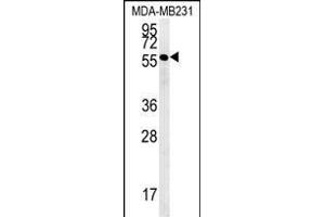 RAB11FIP2 Antibody (Center) (ABIN651666 and ABIN2840350) western blot analysis in MDA-M cell line lysates (35 μg/lane).