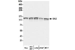 Western Blotting (WB) image for anti-Stromal Antigen 2 (STAG2) (AA 1125-1175) antibody (ABIN7453336)
