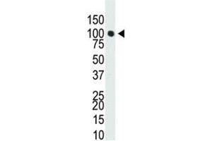 Western Blotting (WB) image for anti-DNA (Cytosine-5-)-Methyltransferase 3 alpha (DNMT3A) (AA 457-486) antibody (ABIN3030750)