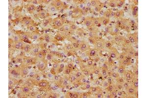Immunohistochemistry (IHC) image for anti-Glutamic-Oxaloacetic Transaminase 1, Soluble (Aspartate Aminotransferase 1) (GOT1) (AA 2-411) antibody (ABIN7144729)
