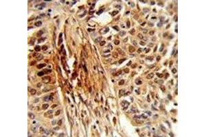 Immunohistochemistry (IHC) image for anti-Peptidylprolyl Cis/trans Isomerase, NIMA-Interacting 1 (PIN1) (AA 30-56) antibody (ABIN3028920)