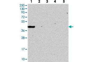 Western blot analysis of Lane 1: RT-4, Lane 2: U-251 MG, Lane 3: Human Plasma, Lane 4: Liver, Lane 5: Tonsil with GIMAP1 polyclonal antibody .