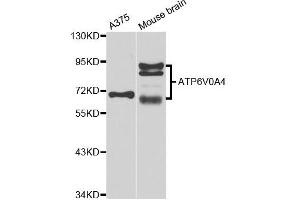 Western blot analysis of extracts of A375 and mouse brain cell lines, using ATP6V0A4 antibody. (ATP6V0A4 抗体)