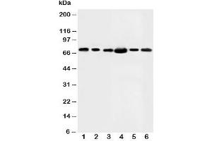 Western blot testing of FAF1 antibody and Lane 1:  rat testis;  2: MM453;  3: MM231;  4: HeLa;  5: SMMC-7721;  6: SW620 (FAF1 抗体  (N-Term))