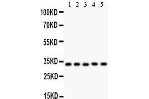 Anti- HMOX1 antibody, Western blotting All lanes: Anti HMOX1  at 0. (HMOX1 抗体  (AA 1-288))