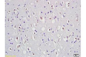 Formalin-fixed and paraffin embedded rat brain labeled with Anti-Phospho-Dab1 (Tyr232) Polyclonal Antibody, Unconjugated (ABIN684343) at 1:200 followed by conjugation to the secondary antibody and DAB staining