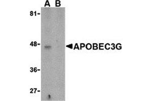 Western Blotting (WB) image for anti-Apolipoprotein B mRNA Editing Enzyme, Catalytic Polypeptide-Like 3G (APOBEC3G) (N-Term) antibody (ABIN1031236) (APOBEC3G 抗体  (N-Term))