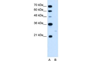 Western Blotting (WB) image for anti-MAX Interactor 1 (MXI1) antibody (ABIN2460213) (MXI1 抗体)