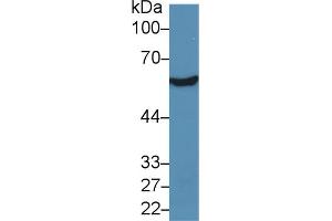 Western blot analysis of Rat Liver lysate, using Human ALDH7A1 Antibody (5 µg/ml) and HRP-conjugated Goat Anti-Rabbit antibody (