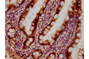 Immunohistochemical of paraffin-embedded human small intestinal tissue using ABIN7153439 at dilution of 1:100 (Galectin 3 抗体)