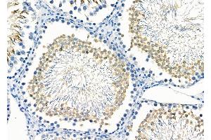 ABIN6265738 and ABIN6266686 at 1/100 staining Rat testis tissue by IHC-P. (TRIM38 抗体  (Internal Region))