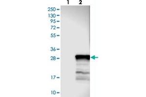 Western blot analysis of Lane 1: Negative control (vector only transfected HEK293T lysate), Lane 2: Over-expression Lysate (Co-expressed with a C-terminal myc-DDK tag (~3. (TEX33 抗体)
