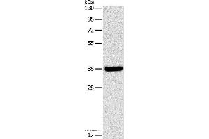 Western blot analysis of Human fetal liver tissue, using FGL1 Polyclonal Antibody at dilution of 1:1050 (FGL1 抗体)