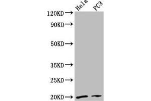Western Blot Positive WB detected in: Hela whole cell lysate, PC-3 whole cell lysate All lanes: NDUFAF2 antibody at 2. (NDUFAF2 抗体  (AA 117-169))