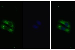 Detection of IL22R in Human HepG2 cell using Polyclonal Antibody to Interleukin 22 Receptor (IL22R) (IL22R 抗体  (AA 267-565))