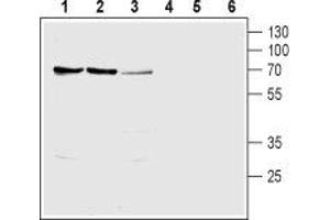 Western blot analysis of rat kidney (lanes 1 and 4), rat liver (lanes 2 and 5) and mouse kidney (lanes 3 and 6) lysates: - 1-3. (SLC28A1 抗体  (Intracellular, N-Term))