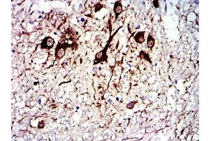 Immunohistochemical analysis of paraffin-embedded medulla oblongata tissues using TUBA8 mouse mAb with DAB staining. (TUBA8 抗体)