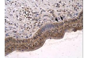 Image no. 3 for anti-Sirtuin 5 (SIRT5) (C-Term) antibody (ABIN6735783) (SIRT5 抗体  (C-Term))