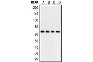 Western blot analysis of NF-kappaB p65 expression in HepG2 (A), MCF7 (B), Raw264. (NF-kB p65 抗体  (Center))