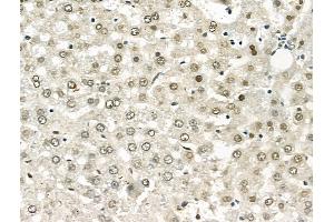 ABIN6262321 and ABIN6268789 at 1/100 staining Rat heart tissue by IHC-P.