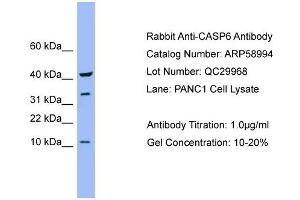 Western Blotting (WB) image for anti-Caspase 6, Apoptosis-Related Cysteine Peptidase (CASP6) (Middle Region) antibody (ABIN2774243)