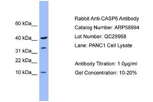WB Suggested Anti-CASP6  Antibody Titration: 0.