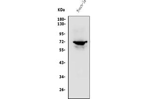 Western blot analysis of P2RX7 using anti-P2RX7 antibody (ABIN7601554).
