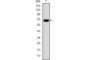 Western blot analysis using FOXP2 mAb against human FOXP2 (AA: 47-287) recombinant protein. (FOXP2 抗体)