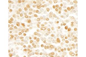 Immunohistochemistry (IHC) image for anti-SR-Related CTD-Associated Factor 11 (SCAF11) (C-Term) antibody (ABIN7454710)