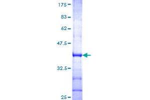 Glutamate Receptor 1 Protein (GLUR1) (AA 201-300) (GST tag)