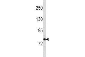 Western Blotting (WB) image for anti-Golgin A6 Family-Like 2 (GOLGA6L2) antibody (ABIN3004545) (GOLGA6L2 抗体)