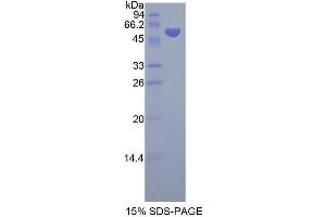 SDS-PAGE analysis of Human NSMASE Protein.