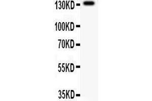 Anti- NMDAR2C Picoband antibody, Western blotting All lanes: Anti NMDAR2C  at 0. (GRIN2C 抗体  (AA 43-242))