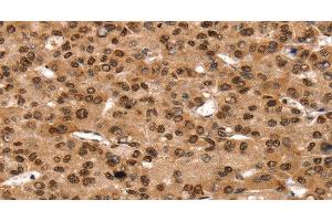Immunohistochemistry (Paraffin-embedded Sections) (IHC (p)) image for anti-TAF10 RNA Polymerase II, TATA Box Binding Protein (TBP)-Associated Factor, 30kDa (TAF10) antibody (ABIN7239503)