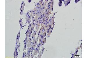 Formalin-fixed and paraffin embedded rat pancreas tissue labeled with Anti-FAF1 Polyclonal Antibody, Unconjugated (ABIN675309) followed by conjugation to the secondary antibody and DAB staining (FAF1 抗体  (AA 551-650))