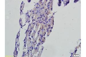 Formalin-fixed and paraffin embedded rat pancreas tissue labeled with Anti-FAF1 Polyclonal Antibody, Unconjugated (ABIN675309) followed by conjugation to the secondary antibody and DAB staining (FAF1 抗体  (AA 551-650))