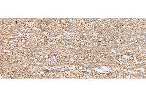 Immunohistochemistry of paraffin-embedded Human brain tissue using IDO2 Polyclonal Antibody at dilution of 1:45(x200) (IDO2 抗体)