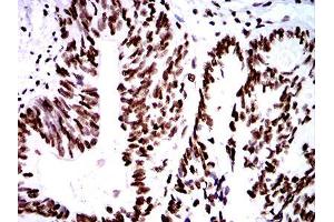 Immunohistochemistry (IHC) image for anti-ZFP91 Zinc Finger Protein (ZFP91) (AA 162-304) antibody (ABIN5542699)