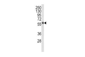 Western blot analysis of ALDH3B1 Antibody (Center) (ABIN652651 and ABIN2842437) in MDA-M cell line lysates (35 μg/lane). (ALDH3B1 抗体  (AA 334-360))