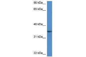 WB Suggested Anti-Dhrs3 Antibody   Titration: 1. (DHRS3 抗体  (Middle Region))