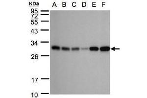 WB Image Sample(30 ug whole cell lysate) A: 293T B: A431 , C: H1299 D: HeLa S3 , E: Hep G2 , F: Raji , 12% SDS PAGE antibody diluted at 1:1000 (AK4 抗体)