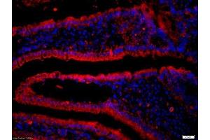 Immunofluorescence (Paraffin-embedded Sections) (IF (p)) image for anti-CD19 Molecule (CD19) (AA 151-250) antibody (ABIN1387313)
