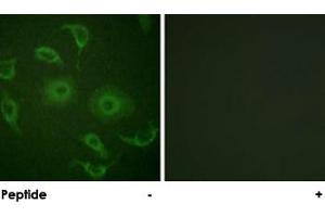 Immunofluorescence analysis of HepG2 cells, using IFNAR1 polyclonal antibody . (IFNAR1 抗体)