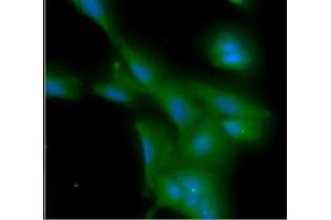 ICC/IF analysis of MYD88 in A549 cells line, stained with DAPI (Blue) for nucleus staining and monoclonal anti-human MYD88 antibody (1:100) with goat anti-mouse IgG-Alexa fluor 488 conjugate (Green). (MYD88 抗体  (AA 1-309))