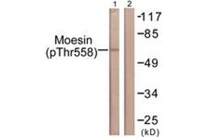 Western blot analysis of extracts from NIH-3T3 cells, using Moesin/Ezrin/Radixin (Phospho-Thr558) Antibody. (Moesin/ezrin/radixin (AA 524-573), (pThr558) 抗体)