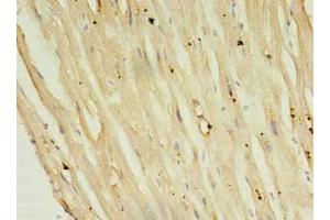 Immunohistochemistry of paraffin-embedded human heart tissue using ABIN7146812 at dilution of 1:100 (Phospholamban 抗体  (AA 1-52))