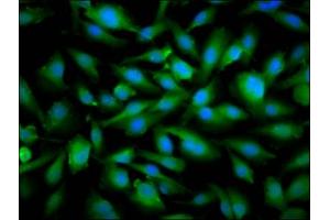 Immunofluorescence staining of U251 cells with ABIN7169865 at 1:66, counter-stained with DAPI.