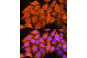 Immunofluorescence analysis of HeLa cells using  Rabbit pAb  at dilution of 1:100. (ASS1 抗体  (AA 1-412))